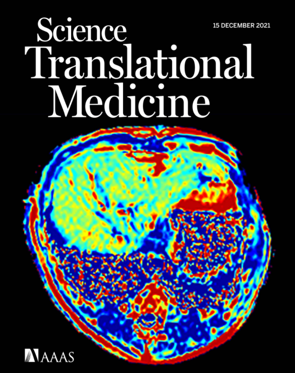Science, Translational, Medicine, MPD, Feature,&nbsp;Article,