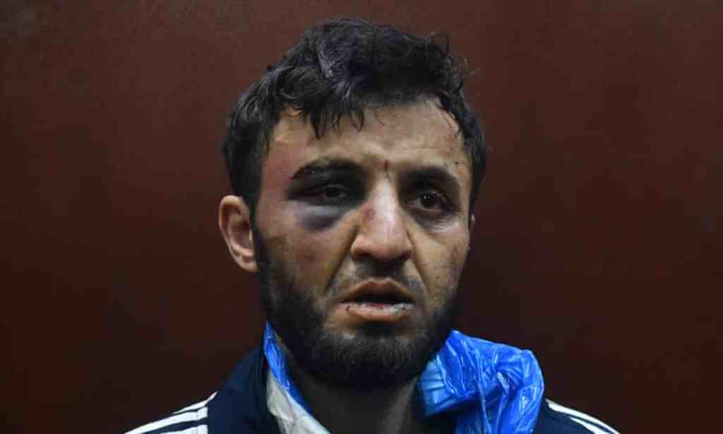 Four suspects in Moscow concert hall terror attack appear in court | Moscow concert hall attack | The&nbsp;Guardian